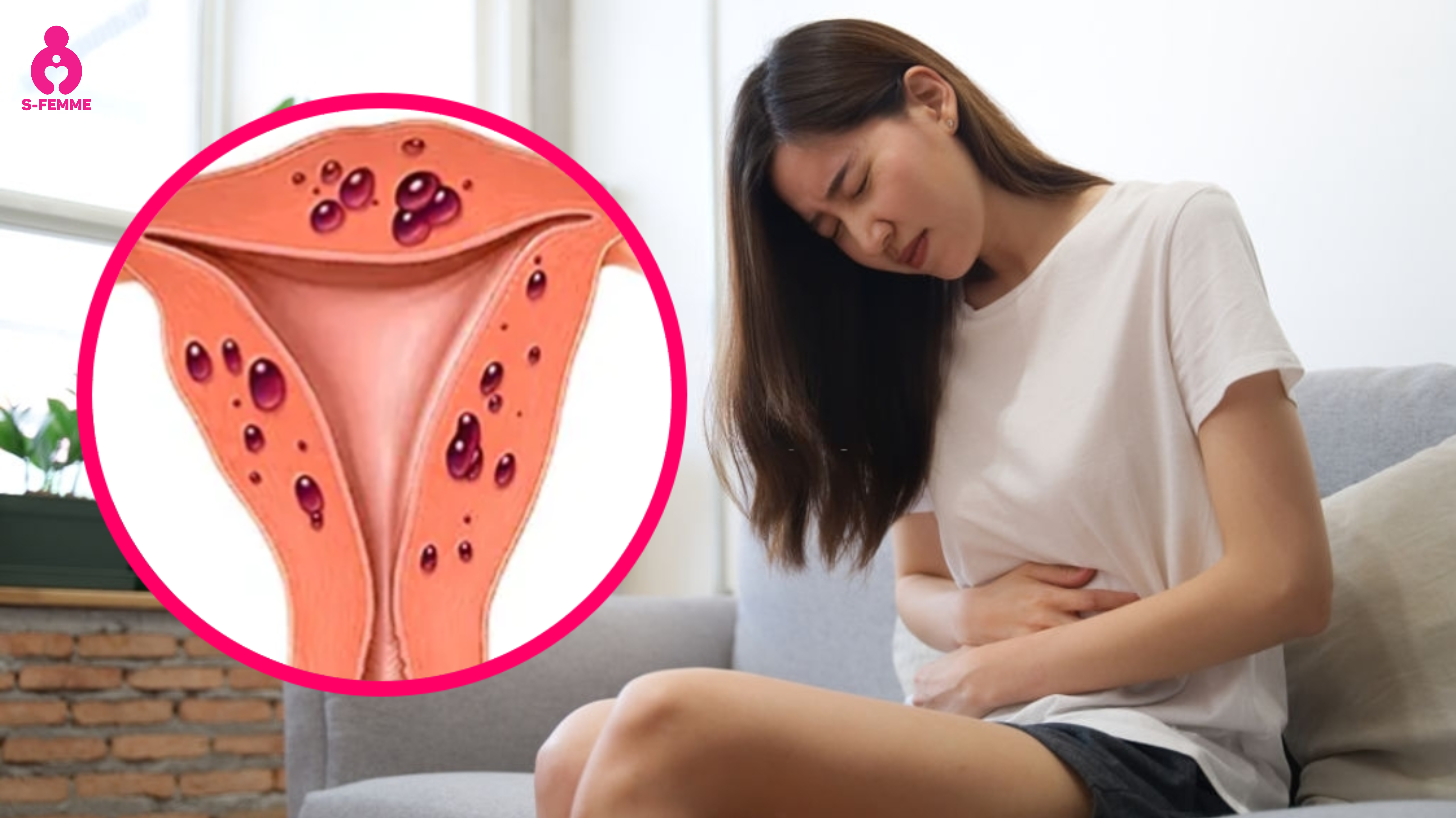 Lạc nội mạc tử cung ảnh hưởng thế nào đến khả năng mang thai