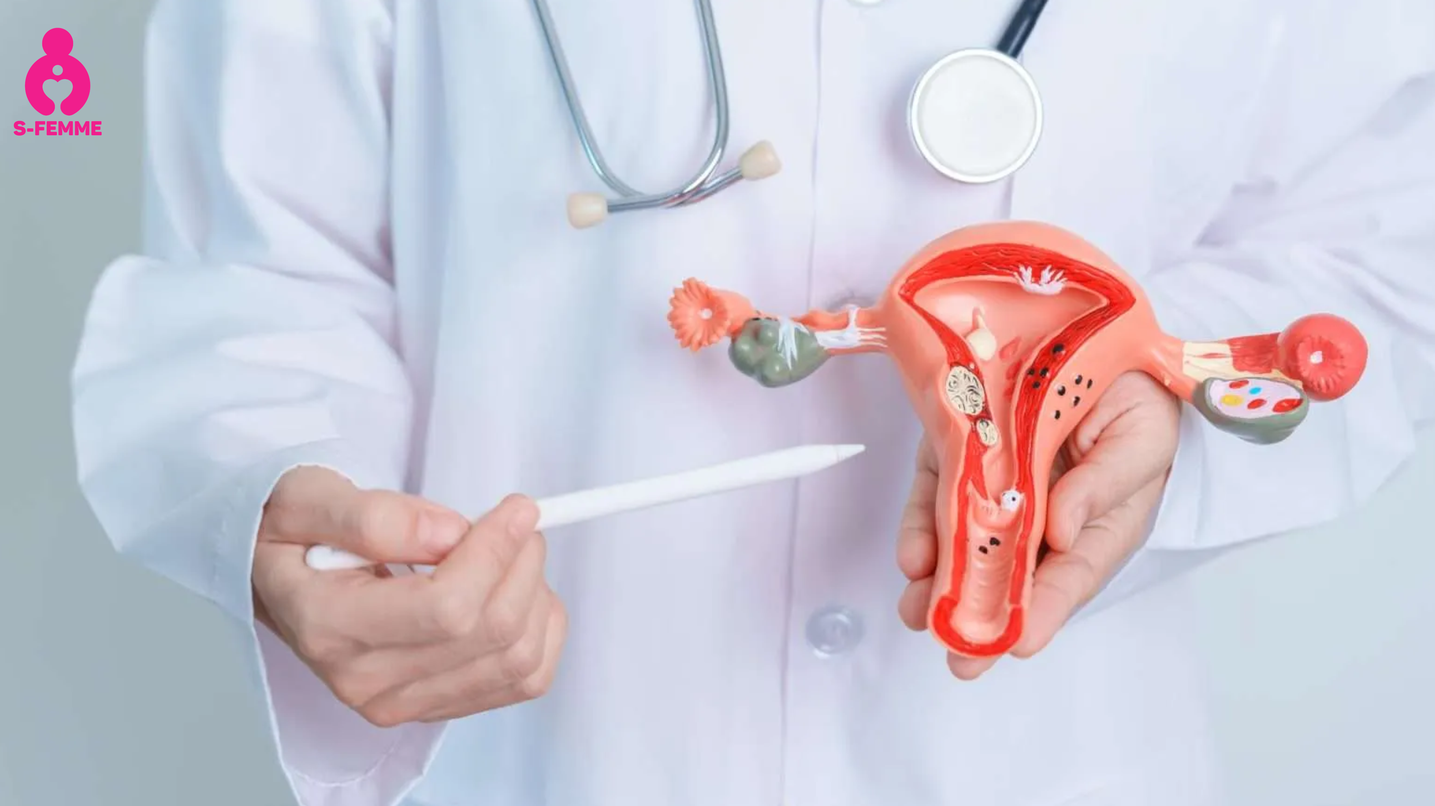 Nguyên nhân và cơ chế bệnh sinh của PCOS